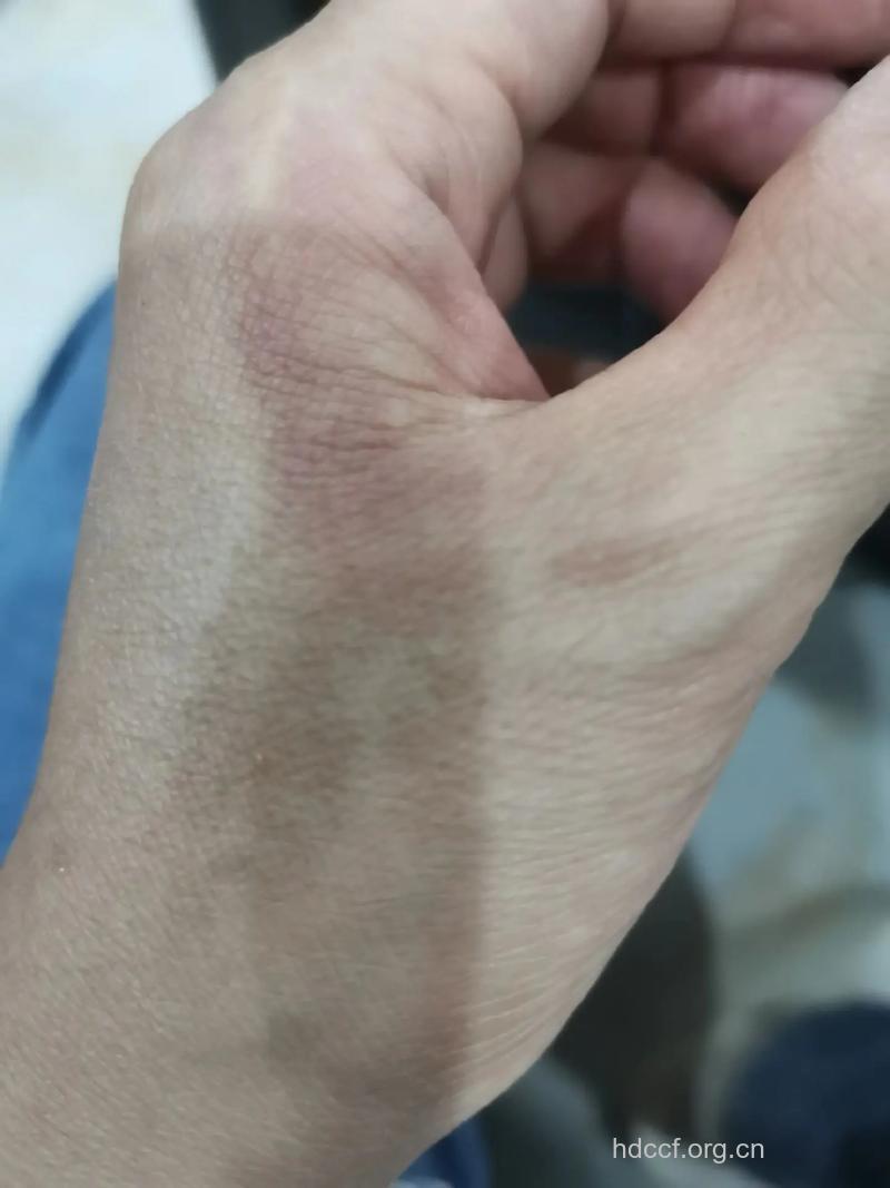男子不育背后黑手有哪些