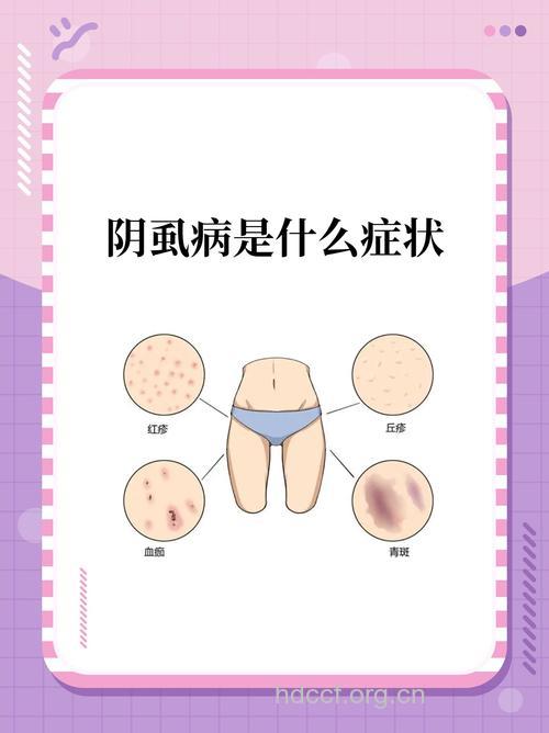 阴虱病的3个明显症状