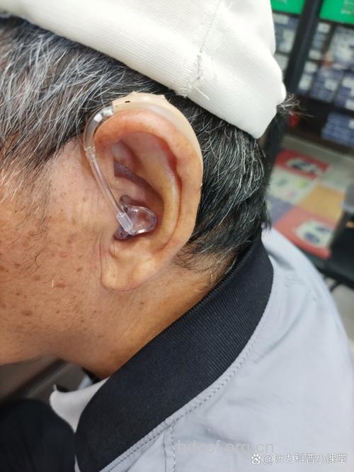 戴了助听器 耳朵却越来越聋了?