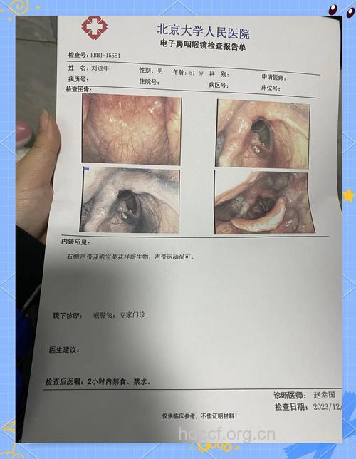 确诊咽喉癌要做哪些检查