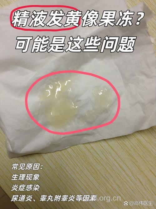 精子颜色很淡 精子成活率低的三大症状表现