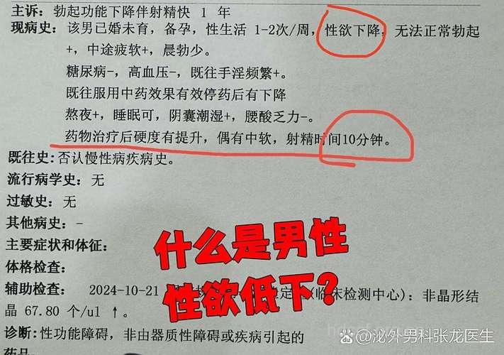 导致男性性欲低下的原因