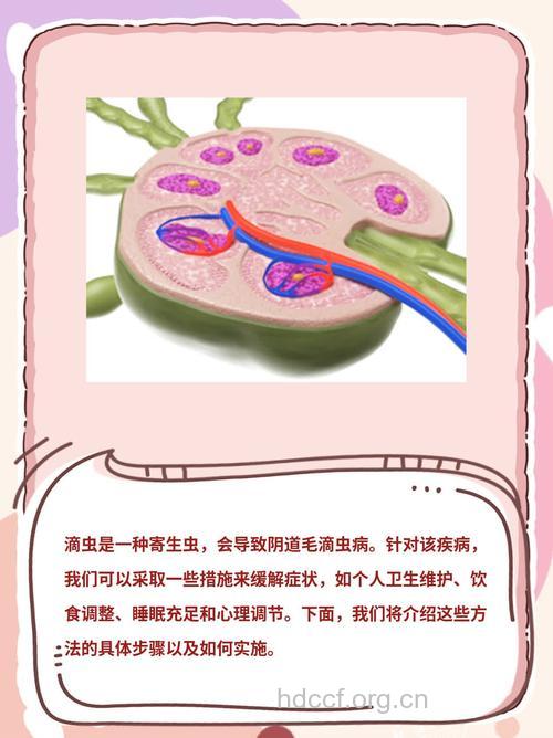 阴道毛滴虫病的传播和预防