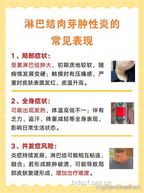 什么原因引起的性淋巴肉芽肿呢？