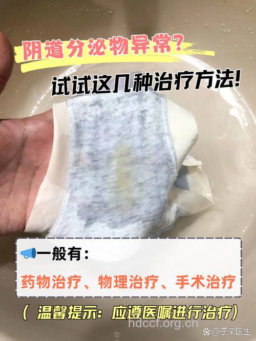 治疗妇女白带 不用愁