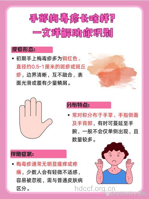 性病真凶 小心就是你的手