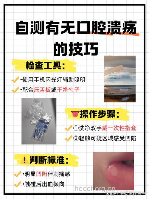中医认为口腔溃疡有分实虚两种类型
