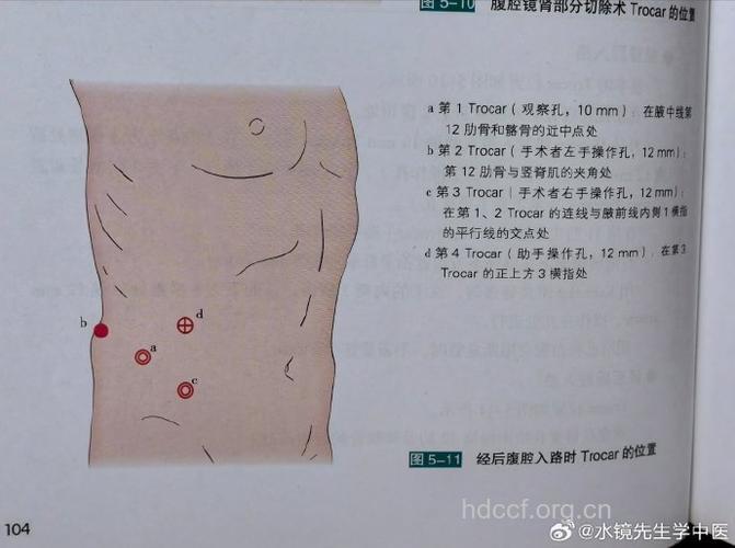 实验室法辅助诊断腹股沟肉芽肿