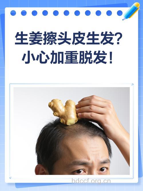 如何防治脱发 生姜能治脱发吗