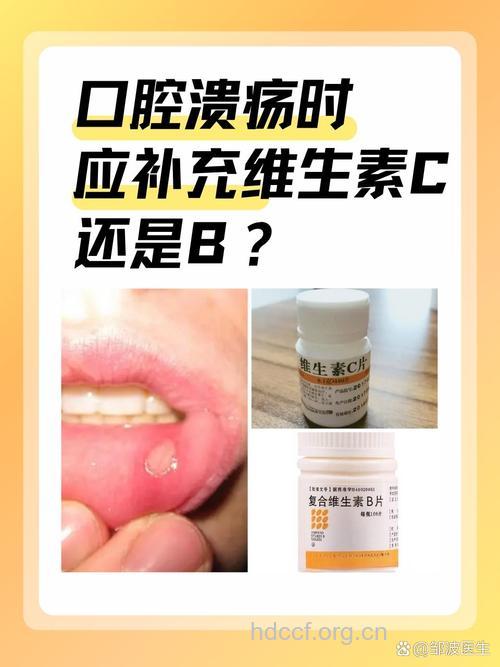 口腔溃疡是缺什么维生素