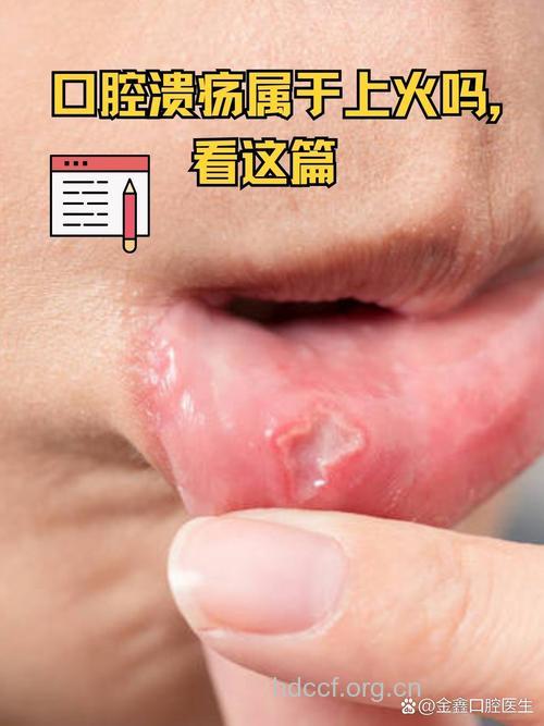 实火与虚火口腔溃疡的症状