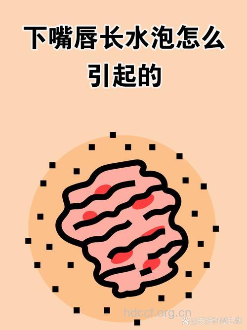 嘴唇长泡治疗方法及注意事项