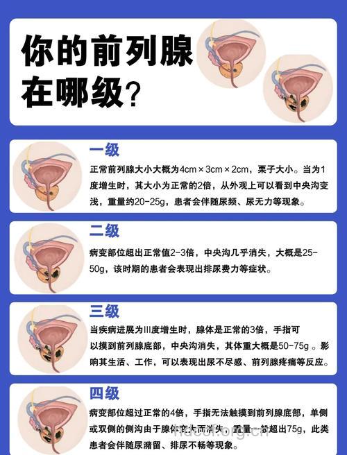 男性如何选内裤防不育