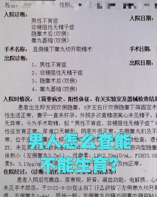 男性不育的九项检查