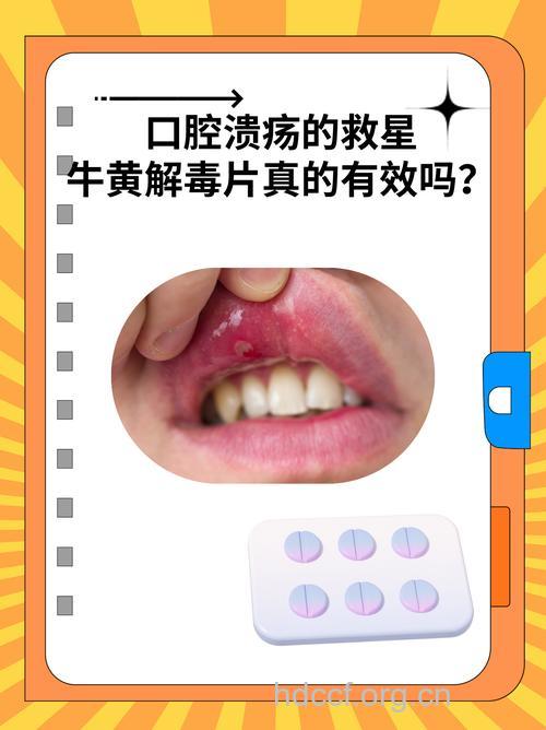 经常口腔溃疡吃黄色食物