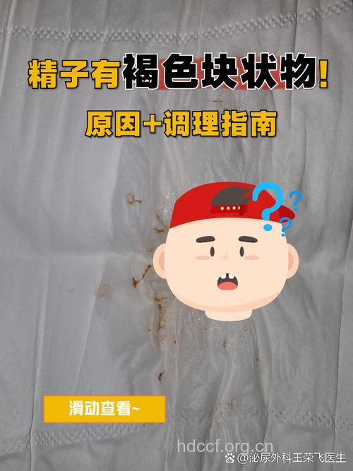 哪些物品会“谋杀”精子