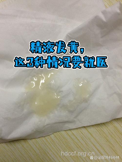 洗涤剂会导致精子活性下降