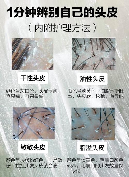 怎么判断头皮是油性还是干性