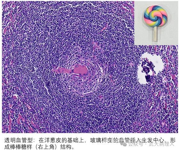 恐怖症病理分析