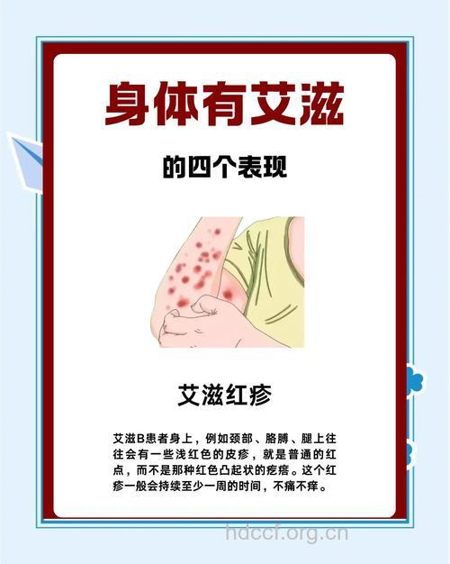 九个信号提醒你感染上艾滋