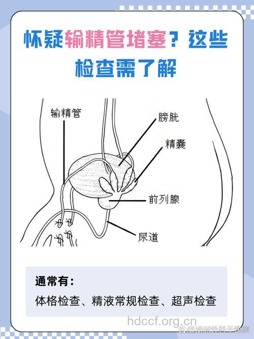 男性输精管堵塞如何检查