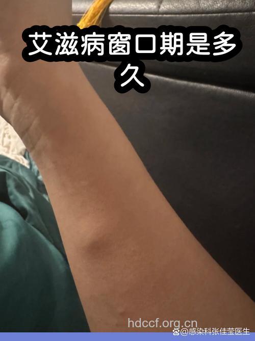 FDA：打美白针或会感染艾滋病