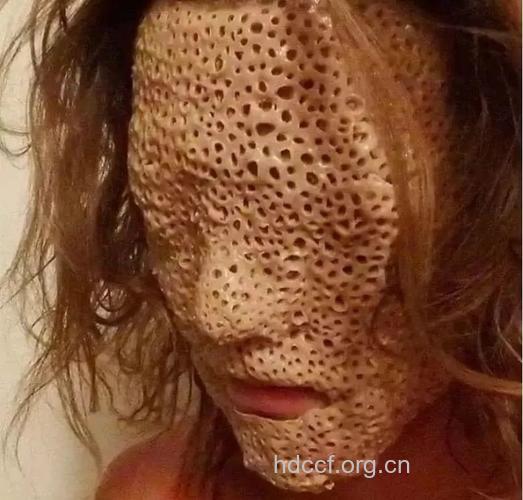 何为丑陋恐惧症