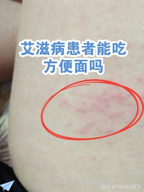 新增艾滋病感染者40%吃过死胎儿