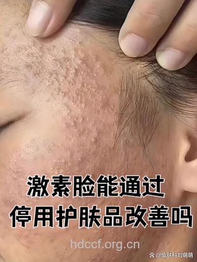 “护肤强迫症”你中枪了吗