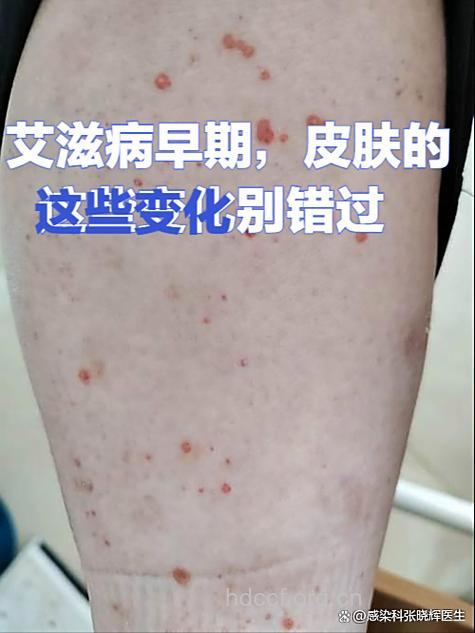 男士常服用伟哥患艾滋病风险更高