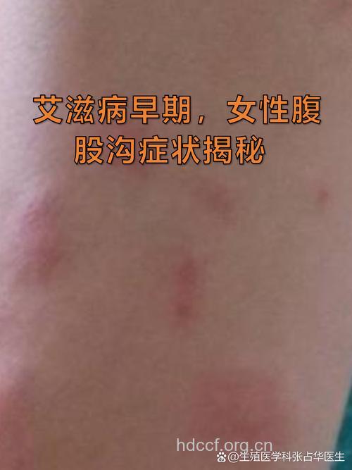 女艾滋病感染者可以要小孩吗
