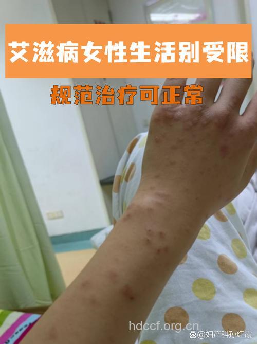 艾滋病预防药物试验失败