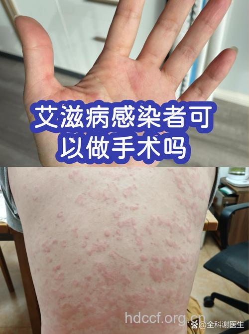 中央人民广播电台拟开播由艾滋感染者主持的节目