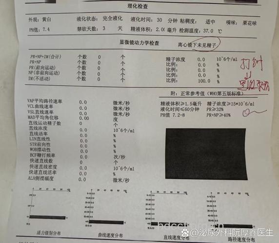 男性无精症要做哪些检查