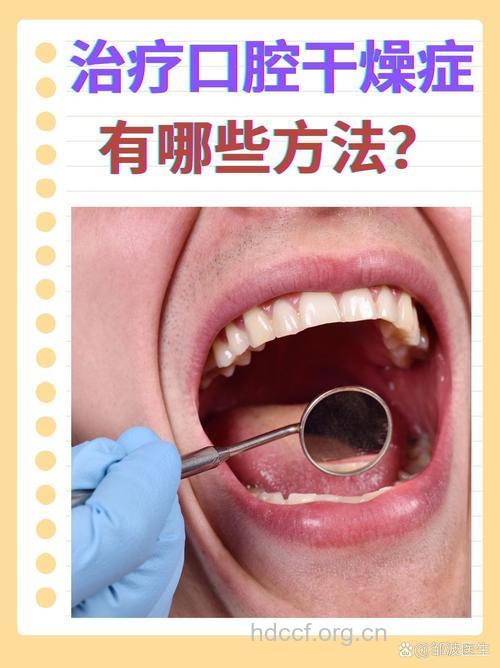 口腔干燥综合症怎么进行治疗
