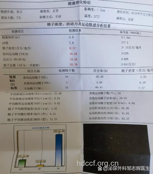 精子活动率 做定量精子制动化试验