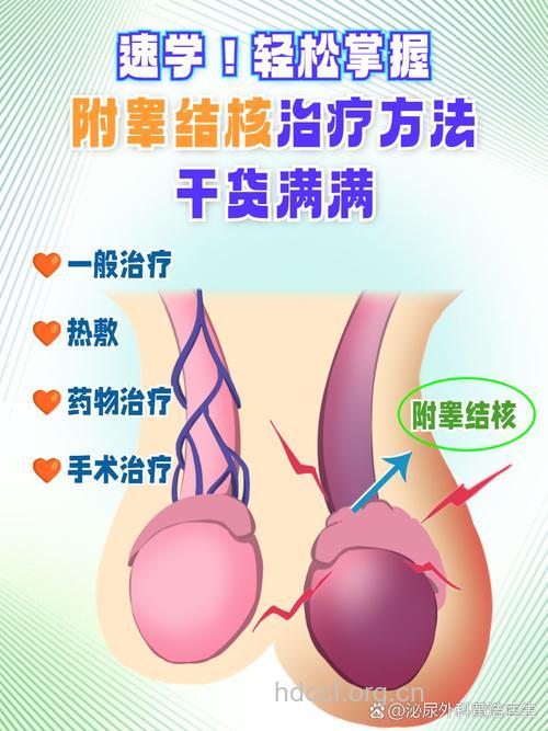 附睾结核可导致不孕不育