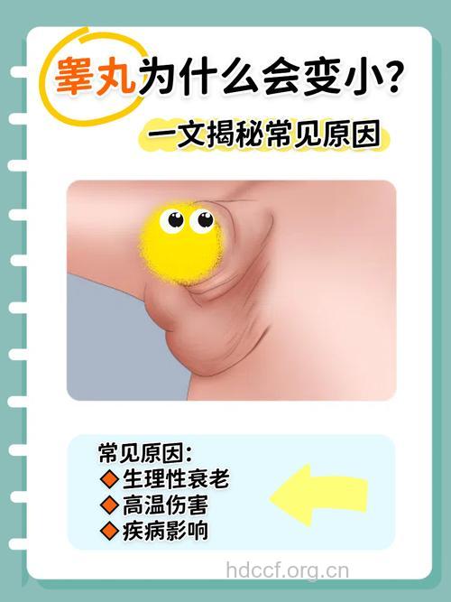 睾丸小导致的不孕不育