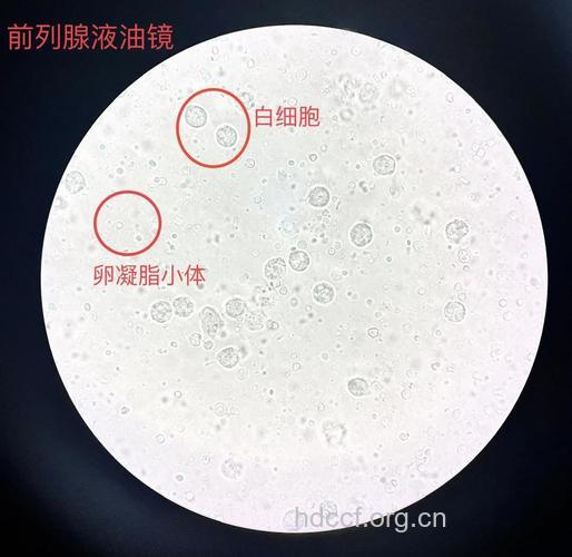 前列腺液中蛋白分析
