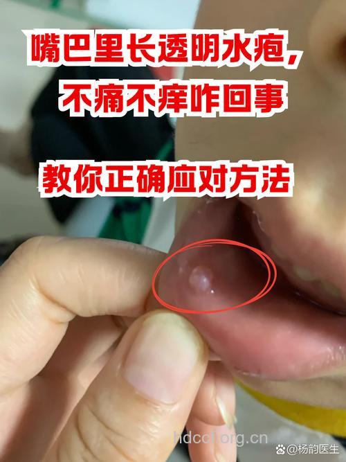 嘴巴里长泡是怎么回事