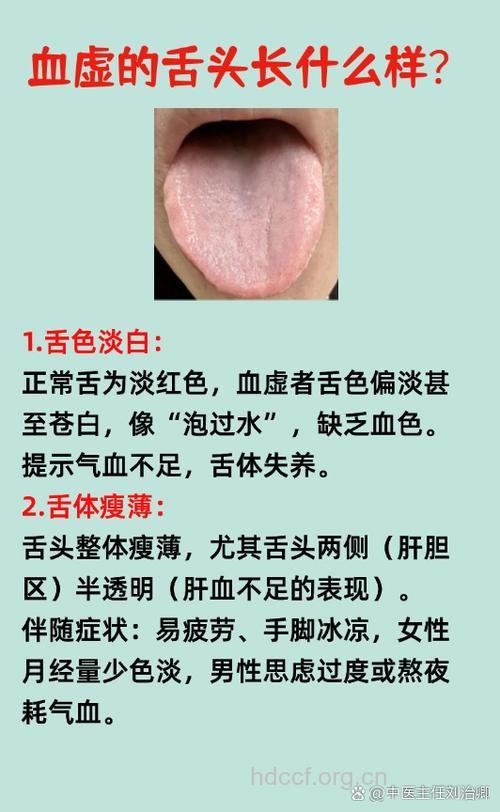 舌头发白没有血色是怎么回事