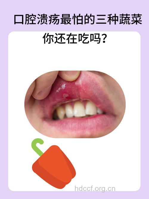 什么蔬菜可防口腔溃疡呢