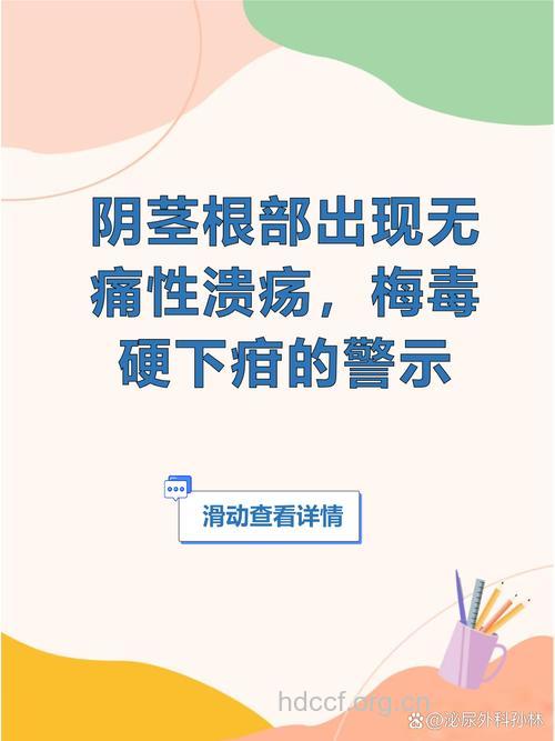 性病不及时治疗 可致男性不育