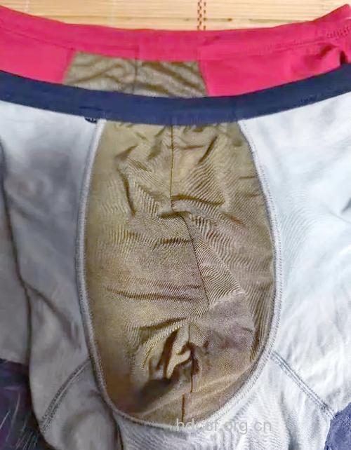 男士常穿铅笔裤 精子质量下降