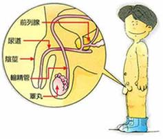 男性生殖器官畸形引起的不育