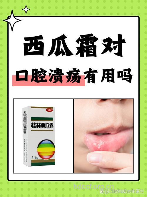 口腔溃疡创面颜色深可服用西瓜霜