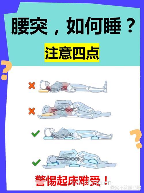 腰椎间盘突出一定要睡硬床吗