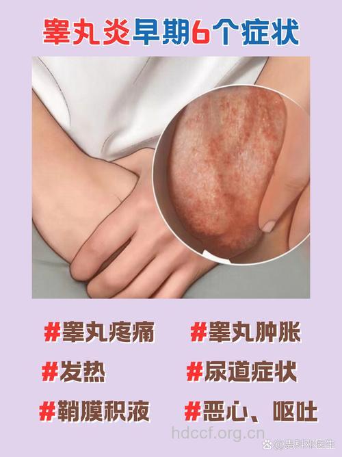 痄腮会引起男性睾丸炎吗？