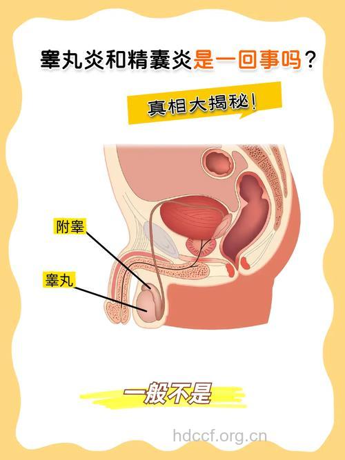 引起男性睾丸炎的基本途径有哪些?