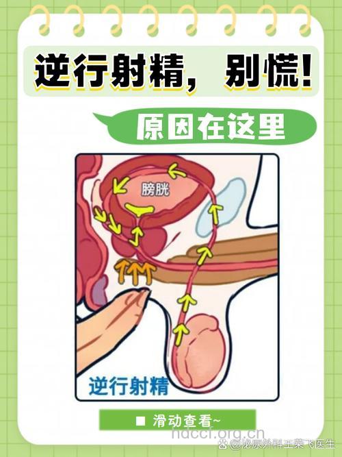 男性逆行射精或导致不育